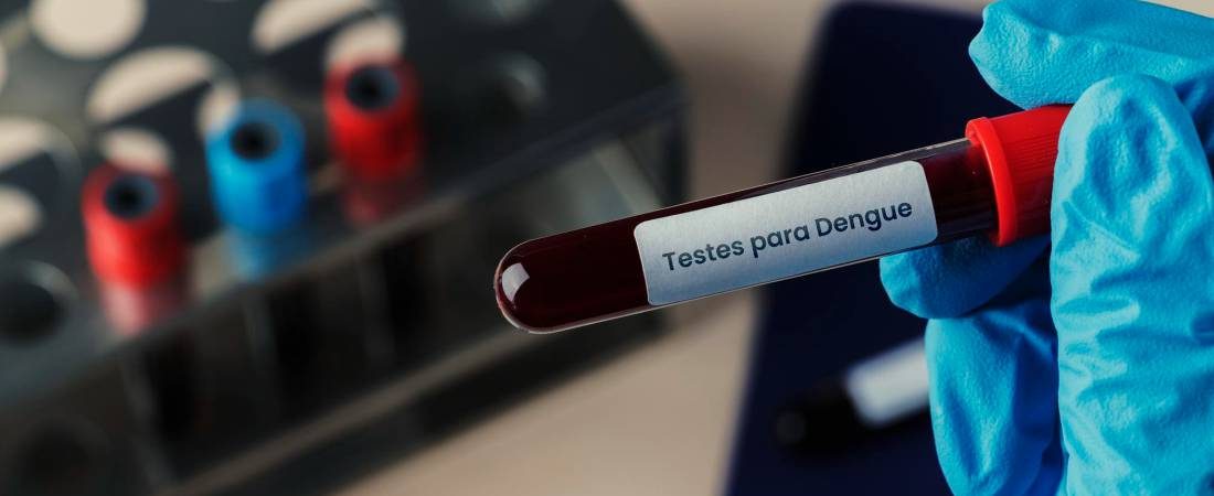 Testes para Dengue é na +Clinic